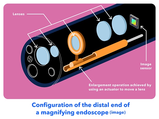Configuration of the distal end of a magnifying endoscope(image) Lenses,Image Sensor,Enlargement operation achieved by using an actuator to move a lens